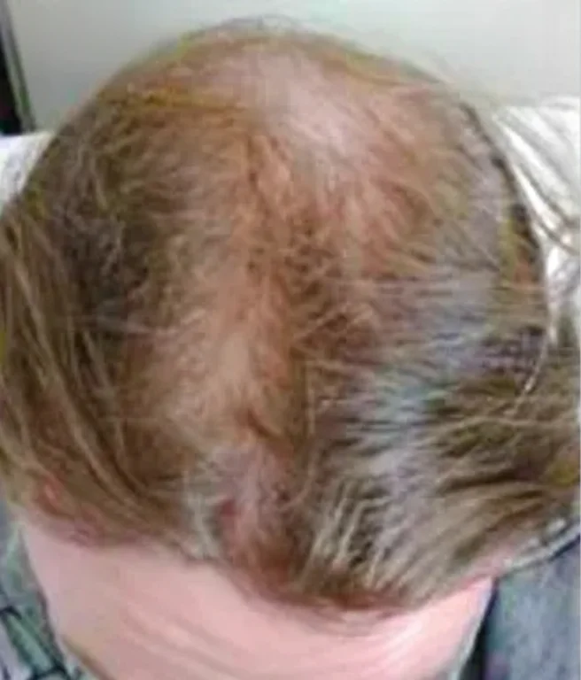 Before