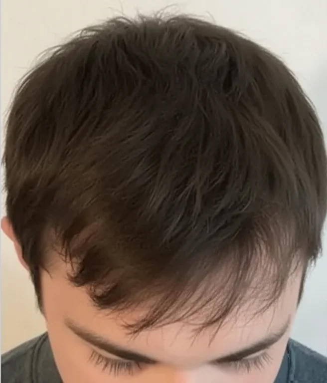 After