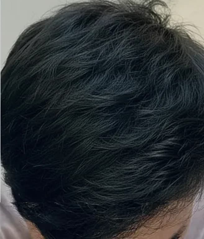 After